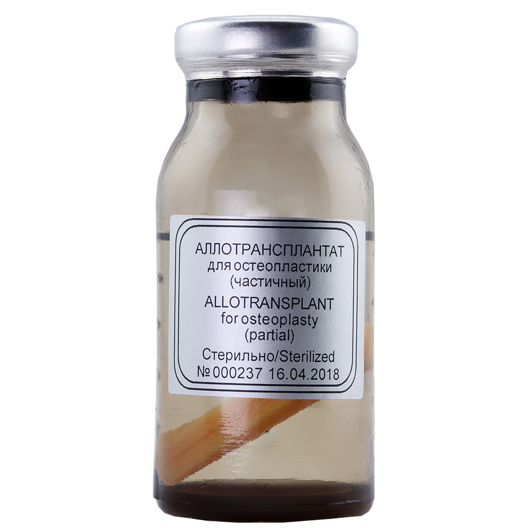 Аллоплант: аллогенный костный материал (блок берцовая кость, 2-4 см.)