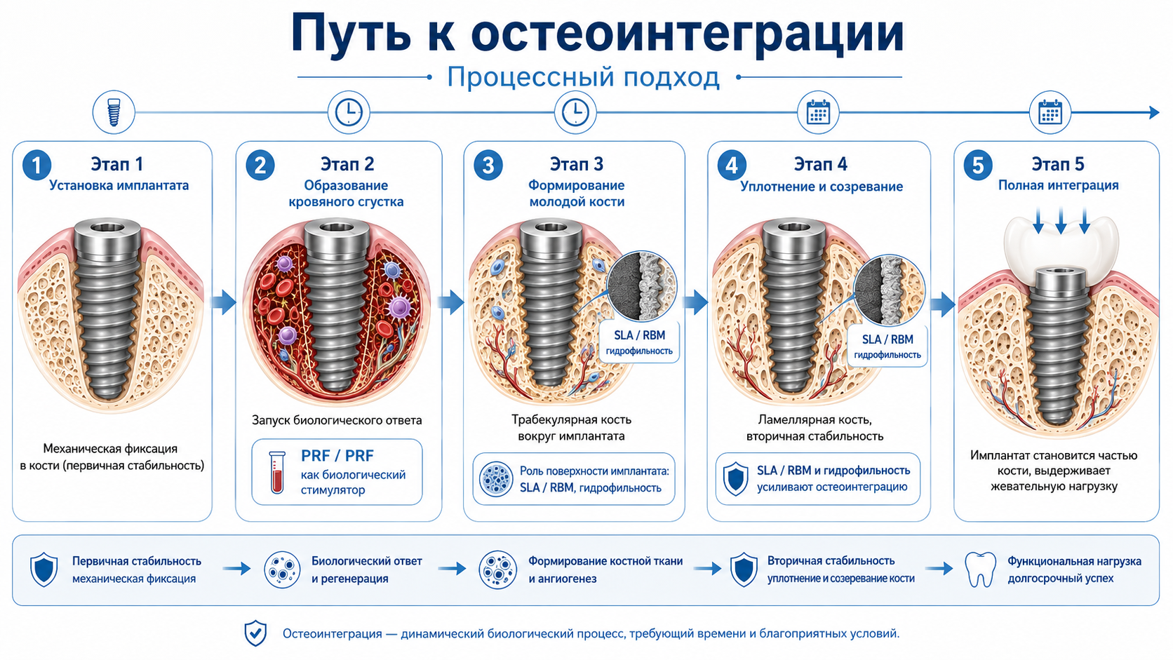 Остеоинтеграция зубного импланта: факторы успеха и как их обеспечить