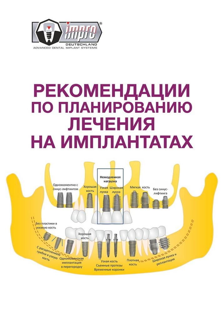 Рекомендации по лечению на имплантатах
