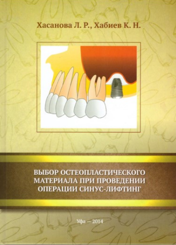 Книга "Выбор остеопластического материала при проведении синус-лифтинга"